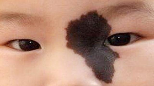 孕期这4件事会影响宝宝"颜值",不想宝宝长胎记变丑,孕妈最好别做