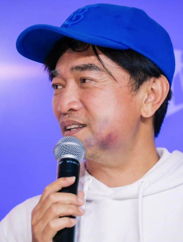 像在嘴里塞了好多东西一般,即使吴宗宪一直在做表情也丝毫不动,甚至