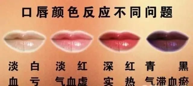 紫唇血淤 白唇血虚 中医读 唇 知健康 6个技巧告知你 腾讯新闻