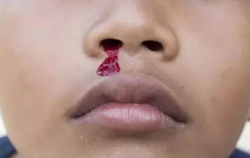 紫唇血淤 白唇血虚 中医读 唇 知健康 6个技巧告知你 腾讯新闻
