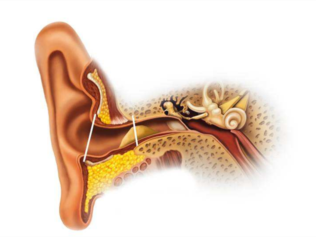 兒科醫生寶寶的耳朵不能隨便掏耳屎太多怎麼辦注意這幾點