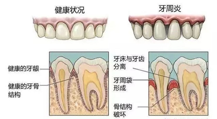 中国干细胞新药防治老掉牙临床显奇效牙齿再生不再是梦