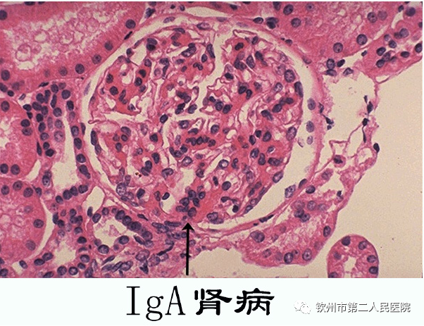 聽專家為您解答關於