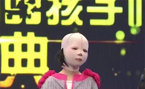 女孩一直戴头套上学,被同学嘲笑是怪物,取下头套后众人湿了眼眶