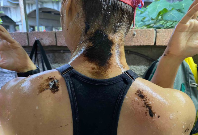 满身恶臭高雄西子湾10多名泳客上岸后身体沾满黑油怀疑是船只偷排