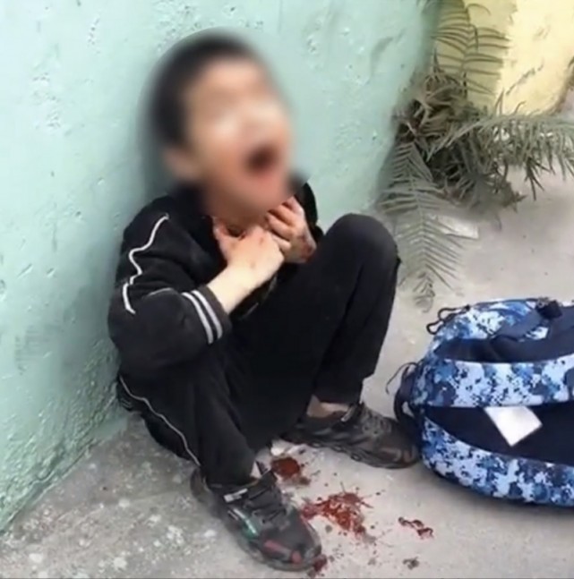 广东揭阳一男孩遭家暴吐血学校回应自家兄弟打架已家访