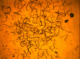 男子被鱼刺扎了一下右手差点保不住年年有人中招