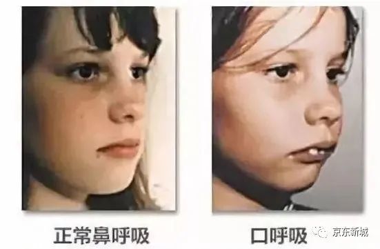 【科普小课堂】用嘴呼吸会让人变丑吗?泡脚要淹没小腿吗?