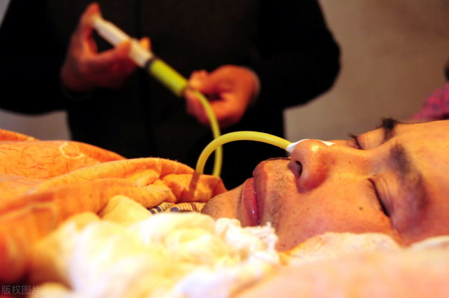 1,植物人仍然活着植物人脑部受到严重损伤,处于无意识觉醒状态.