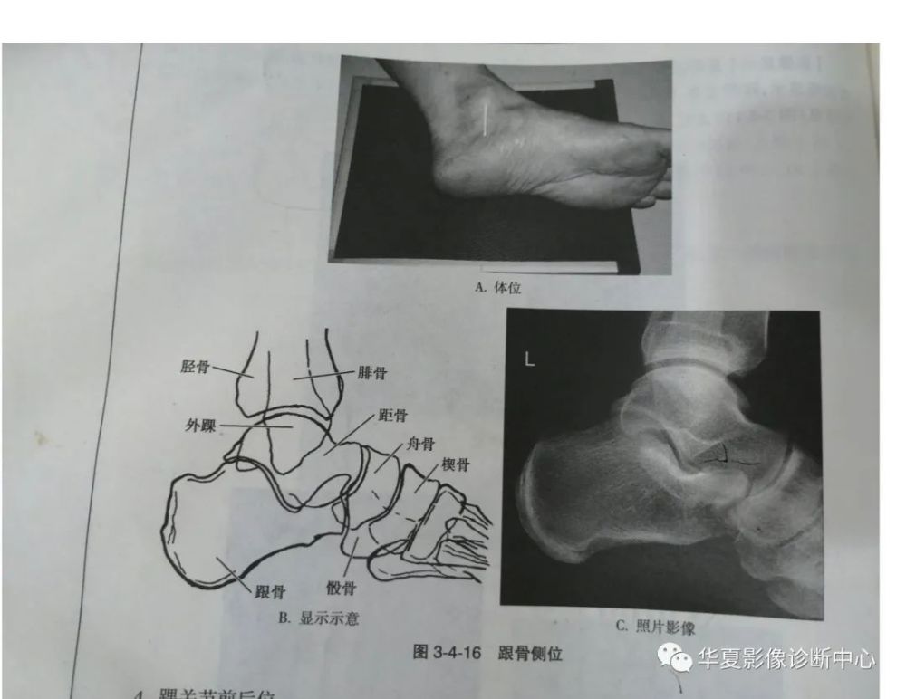 这些常见体位你能否一眼扫过又能一语中的？_腾讯新闻