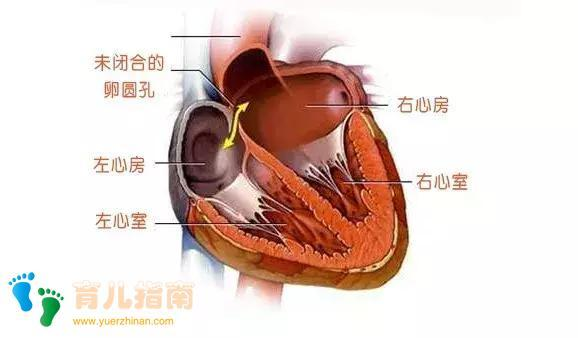 大多数新生儿的卵圆孔在出生后一年内闭合,一般婴儿也没有症状.