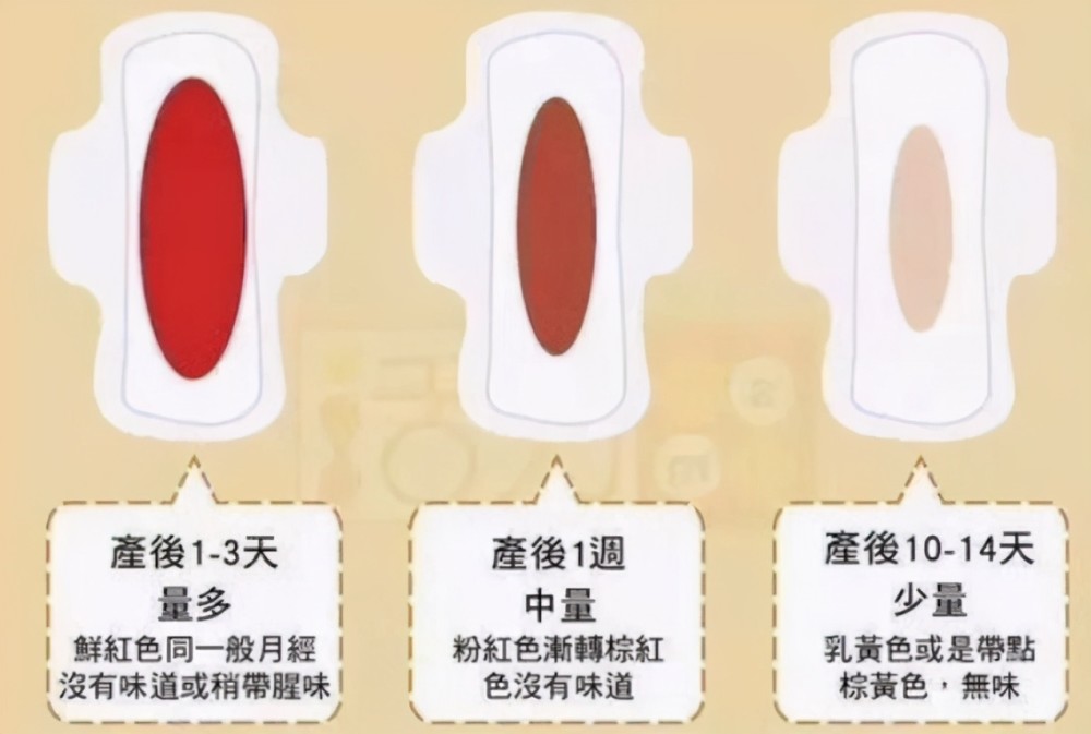 产后恶露不止通常是这3个原因做对三件事给排恶露加个速