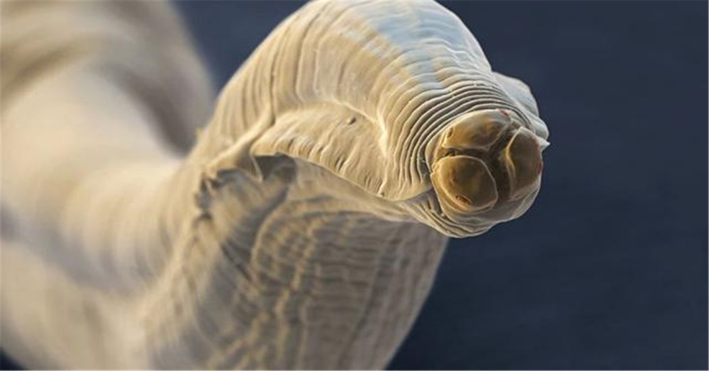 它就是麦地那龙线虫.