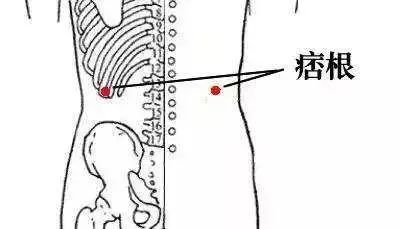 痞根穴健脾和胃