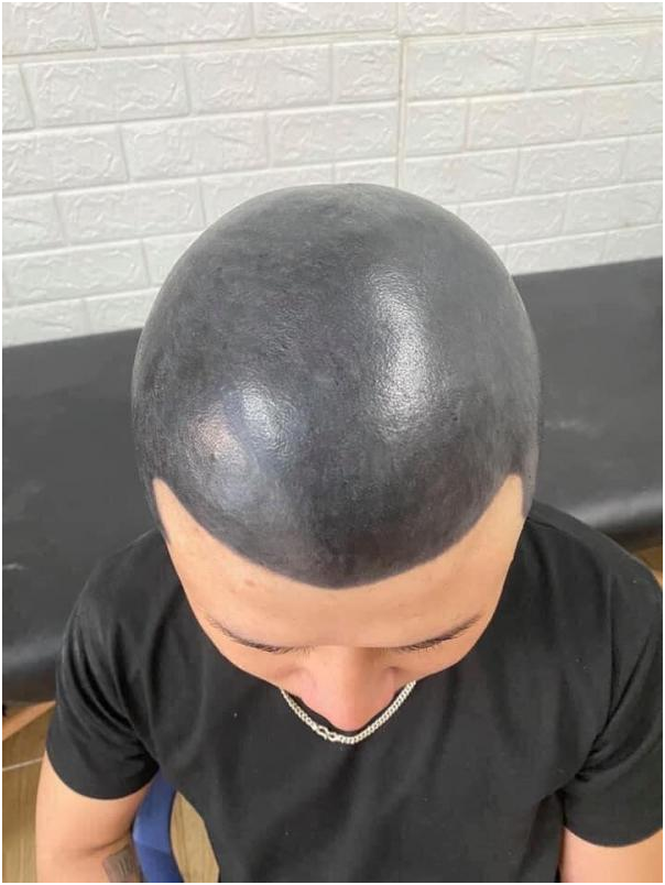 男子剃光头后怕被妻子发现,竟把头皮纹成黑色结果悲剧了