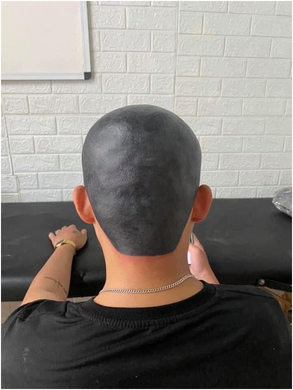 男子剃光头后怕被妻子发现,竟把头皮纹成黑色结果悲剧了