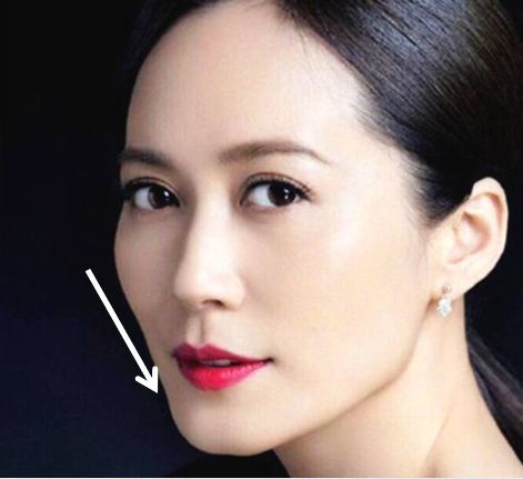 以俞飞鸿为代表,清瘦椭圆脸通常软组织偏少,额头较宽,颧骨微高但不会