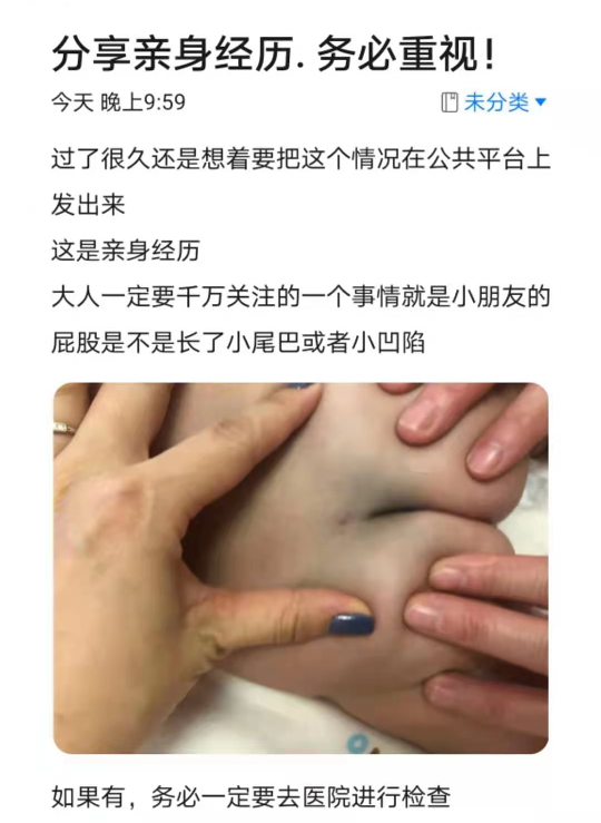 屁屁上端有小凹陷搞不好会瘫痪