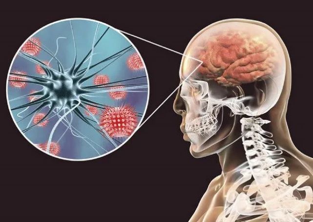 新刊战胜脑膜炎