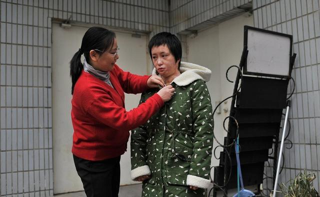 安徽16岁少女周岩因拒绝官二代被泼汽油毁容如今过得怎样了