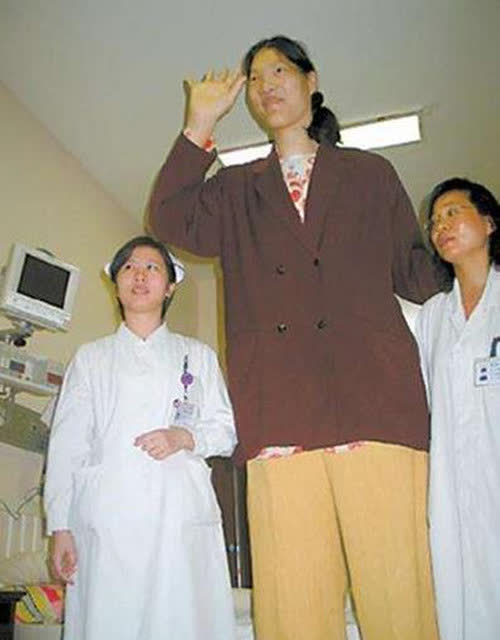 直到现在,雷纳尔都是世界上唯一一个同时患侏儒症和巨人症这2种截然不