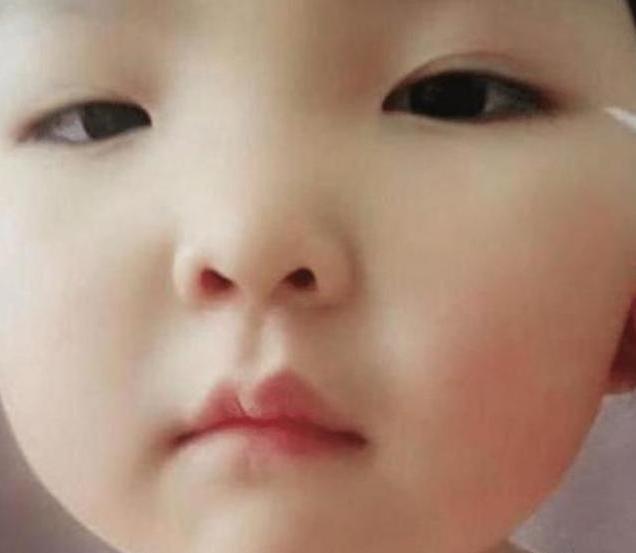 小新(化名)是一个7岁的小女孩,天生就是一对丹凤眼.