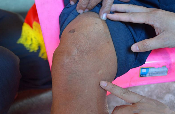 致敬抗日英雄满身伤痕触目惊心与鬼子血腥白刃战胸膛被刺穿