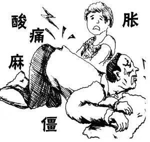 得了腰椎间盘突出你是否也出现了酸痛胀麻的感觉为什么呢67