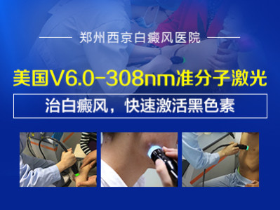 郑州西京医院308激光治疗白癜风多久能够好