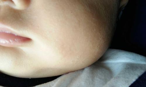 儿科专家3种食物是孩子积食的帮凶娃再喜欢也不能喂