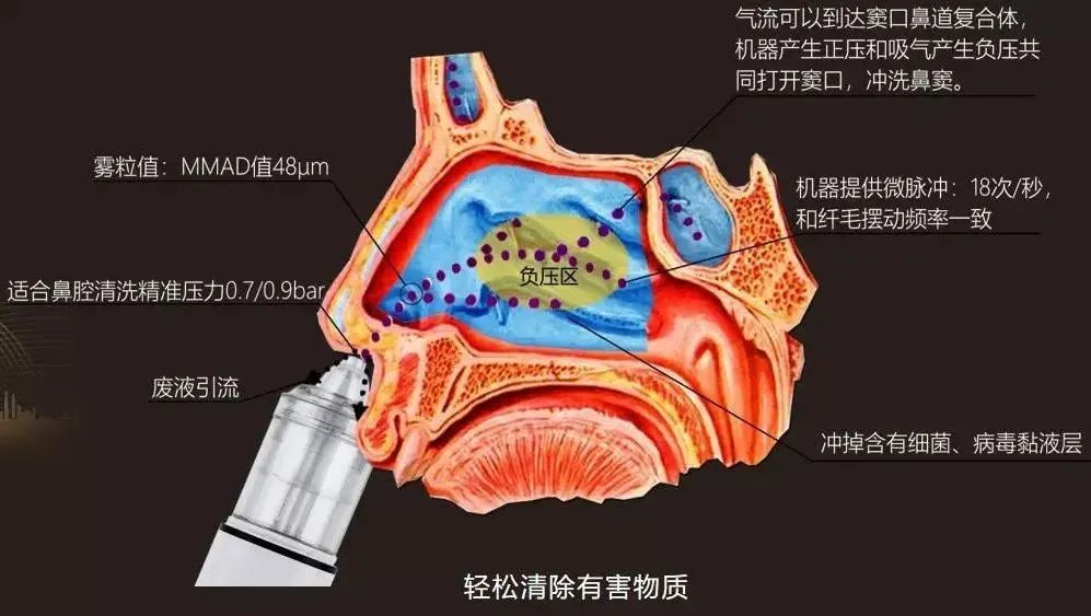 膜第三步:消除炎症,修复损伤细胞,提高细胞活性飞羊鼻腔动力的优点:1
