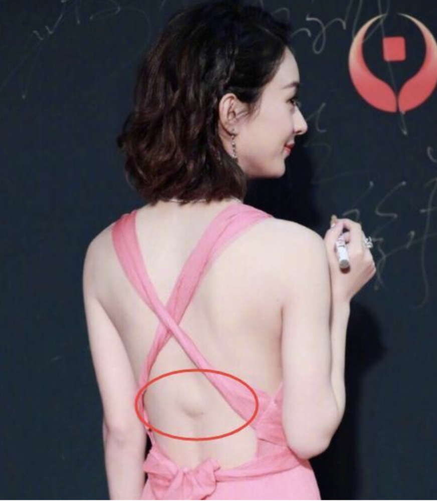 这也就是在后来的红毯活动之中看到赵丽颖后背总有一块小小的凸起,一