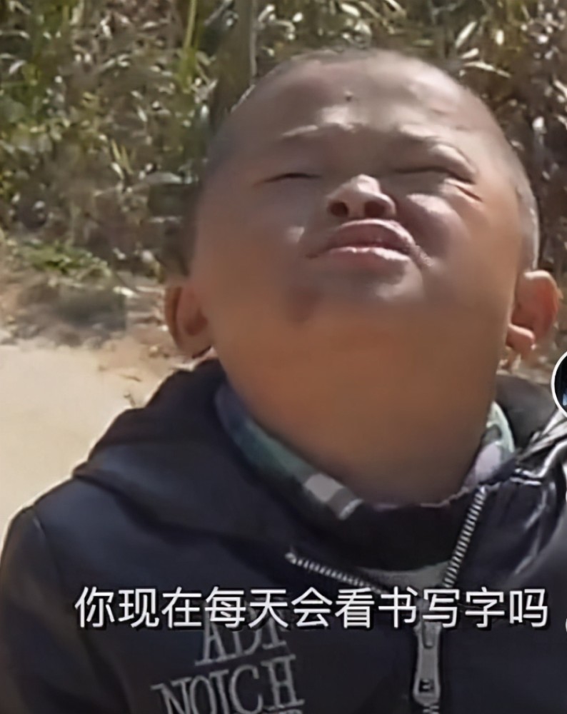 小马云"吐苹果"出现人传人,大批网红争相模仿:人血馒头好吃吗