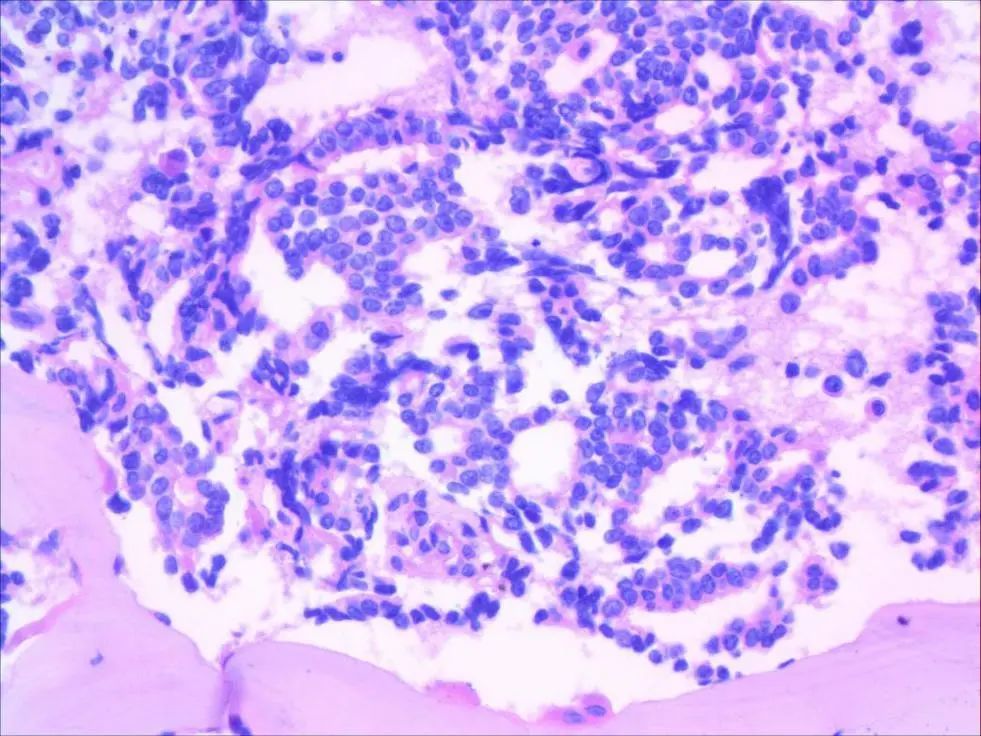 血液形态诊断"侦察兵"发现"多枚不明飞行物"