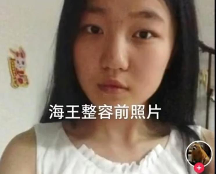 女海王项思醒整容前照片曝光,判若两人,只是想给每个男人一个家