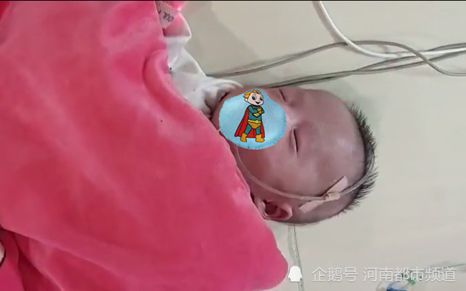 5个月大的早产宝宝又遇"皮罗综合征"_腾讯新闻