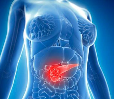 胰腺癌患者的饮食注意事项