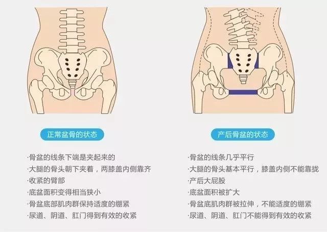 其中骨盆修復的價格是最高的,一般都在一萬 .