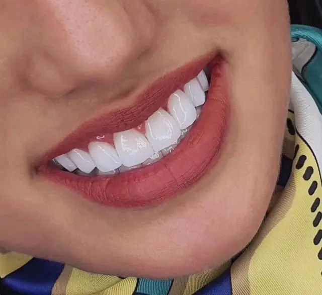 能让男人喜欢的女生,大都有3个特征,牙齿整齐是其一,中2个就行