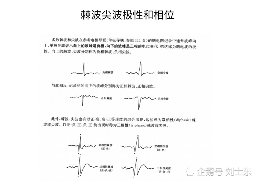 儿童脑电图基础与判读解析 腾讯新闻