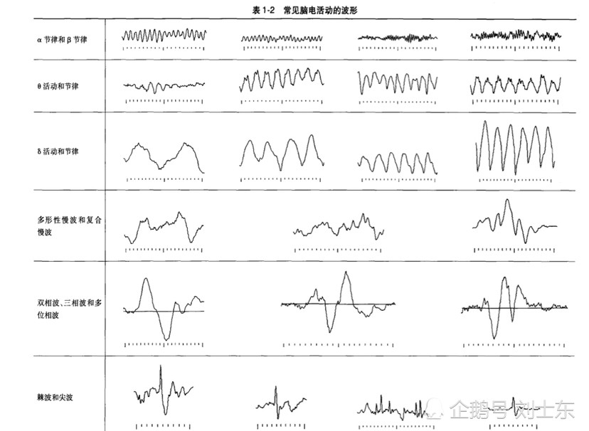 儿童脑电图基础与判读解析 腾讯新闻