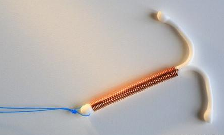 绝经期|节育环|取环|更年期