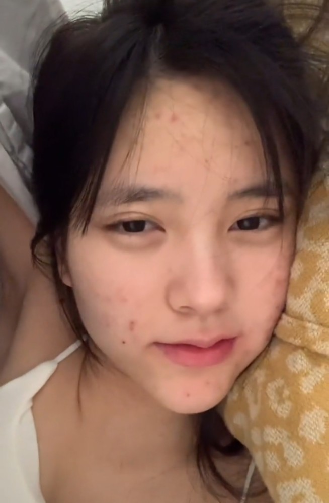 从视频来看,小霸宠的皮肤状态并不是特别好,脸上经