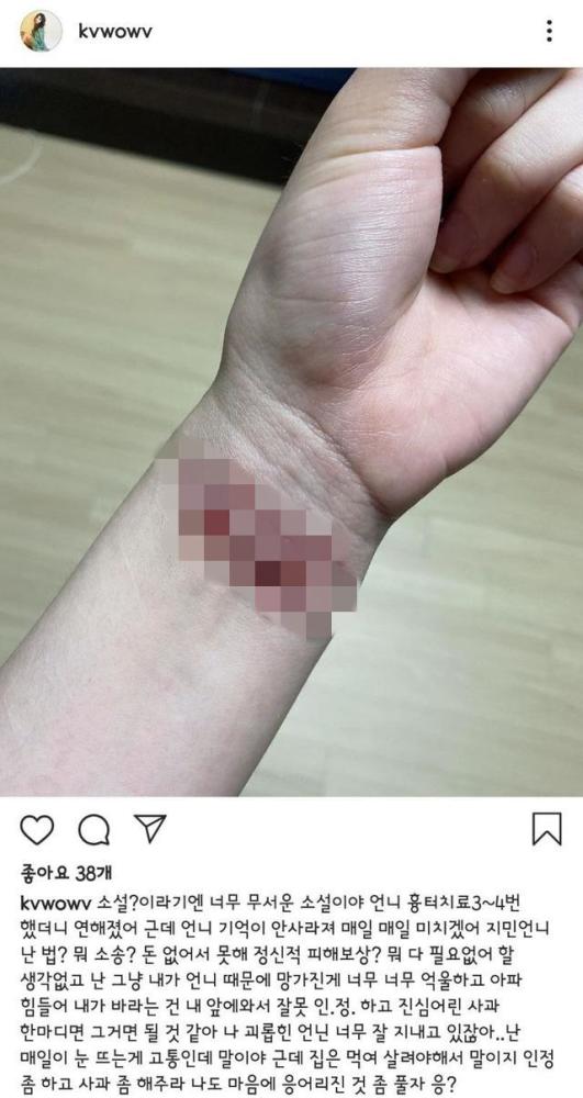 抑郁症缠身前aoa成员权珉娥发割腕照指责护士对她发火