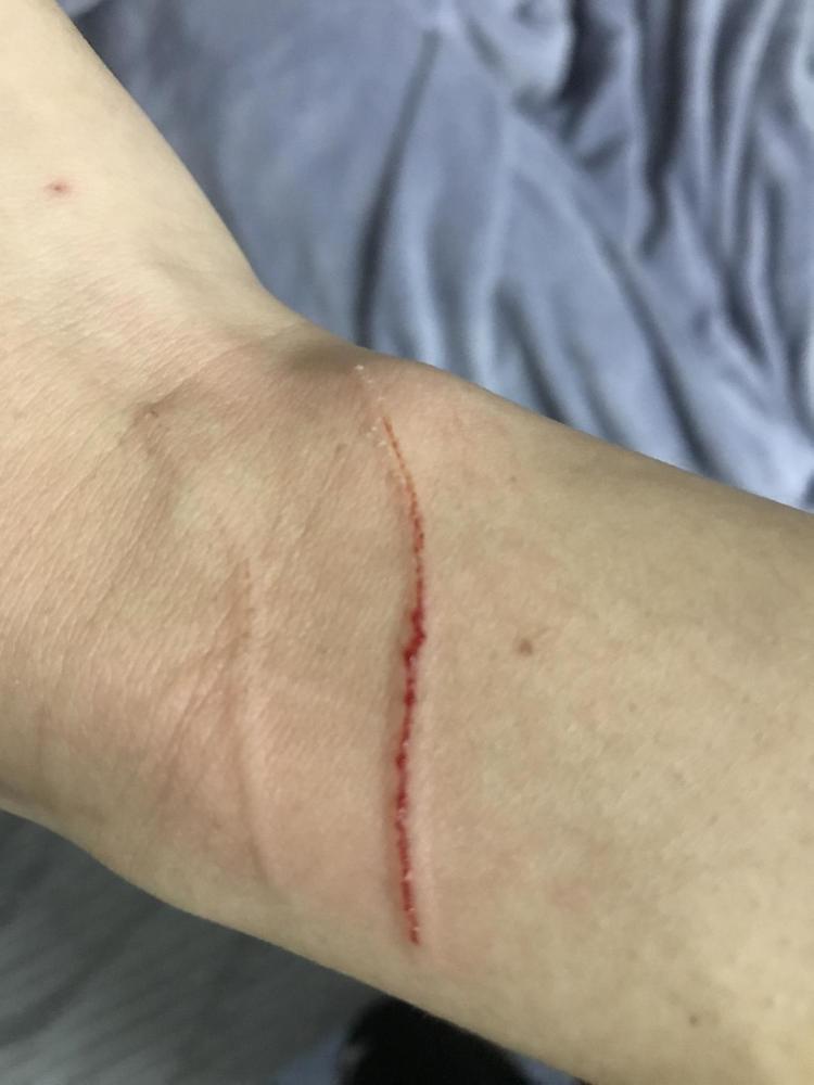 被猫抓伤咬伤有没有必要打狂犬疫苗?