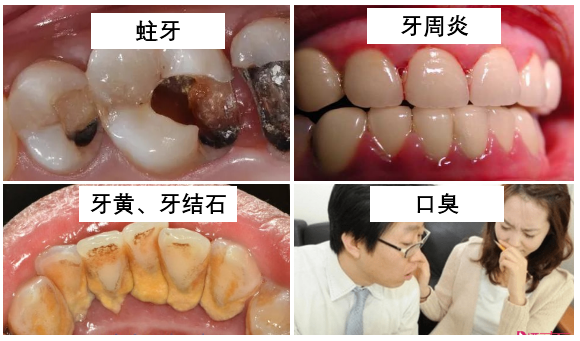 好物|刷完牙用它,1秒衝出