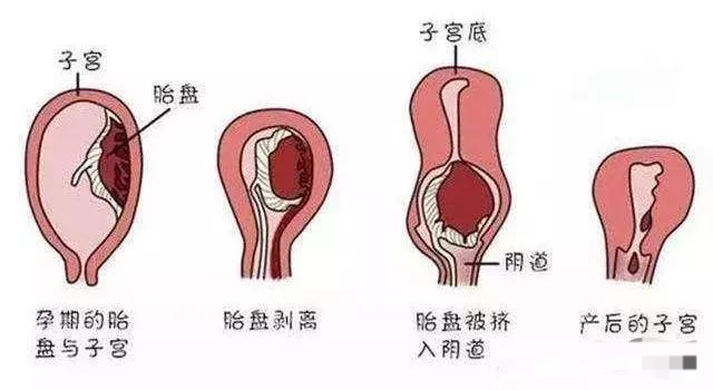 生完孩子又胖了教你甩掉松弛的大肚腩让子宫恢复如初做年轻漂亮辣妈