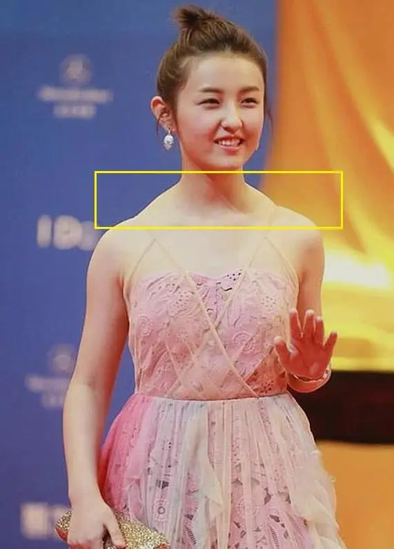 隆起的斜方肌,圆肩显得人脖子短粗,上镜还影响气质,看起来不自信,吊带