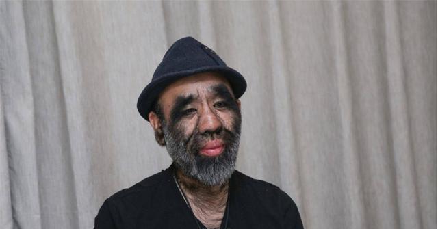 还记得中国毛娃于震寰吗网友好奇他儿子长毛不现在他来了