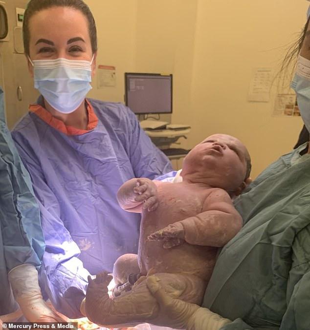 初为人母生下13磅重女儿为英国第二大巨婴肚皮撑得出血